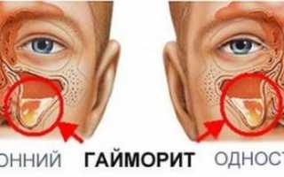 Как правильно лечить болезни?