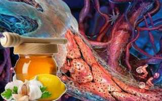 Лучшие продукты снижающие уровень холестерина