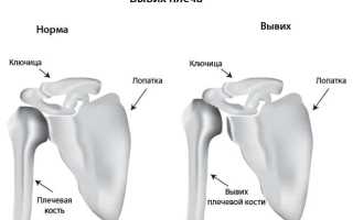Спортивные травмы