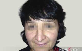 Как убрать жир с коленей — комплекс упражнений